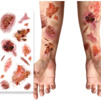 Tatouages temporaires de plaies et de brûlures